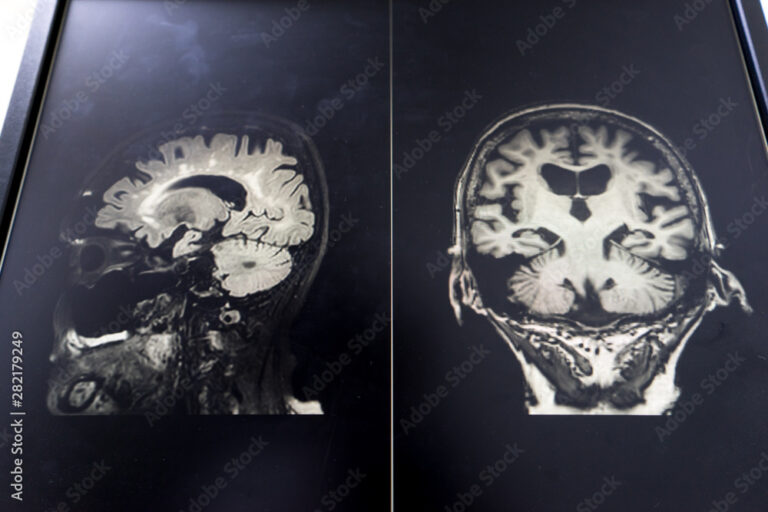 Curso CDME — Curso para Determinação de Morte Encefálica