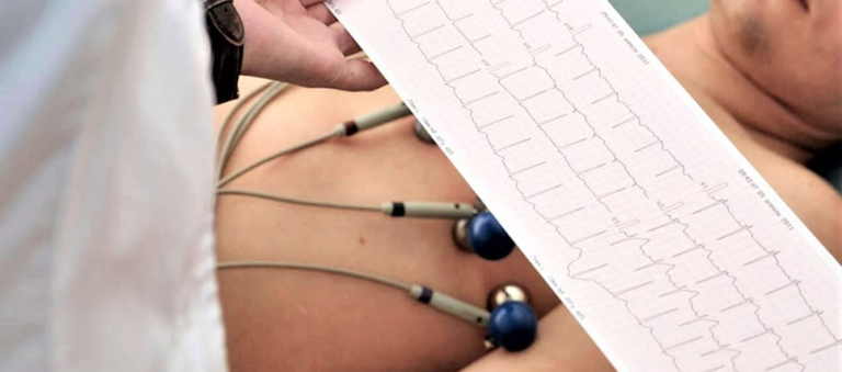 Curso ECG — Eletrocardiograma na Emergência